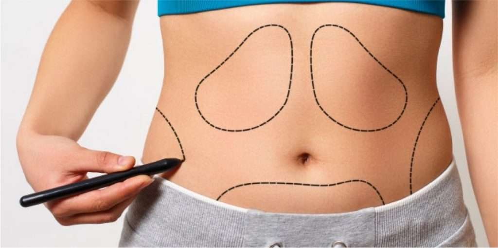 Body Contouring Surgery in Mumbai