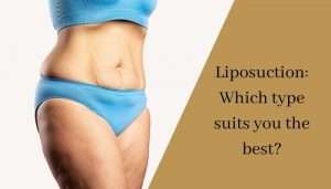 Liposuction Which type suits you the best