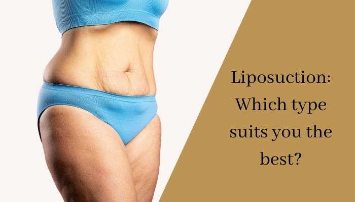 Liposuction Which type suits you the best