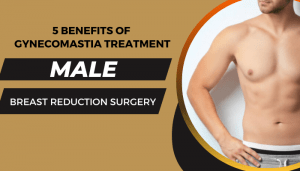 5 Amazing Benefits Of Gynecomastia Treatment (Male Breast Reduction Surgery)