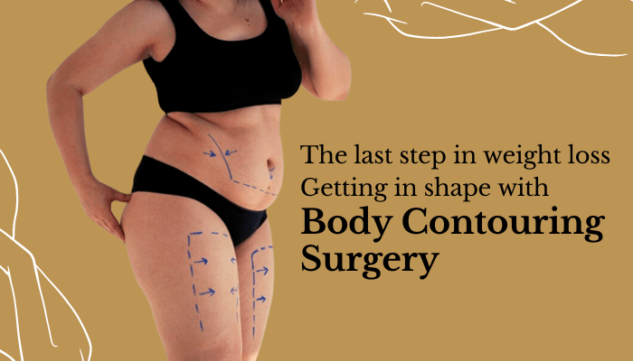 Body Contouring Surgery - Dr. Ashish Ghuge
