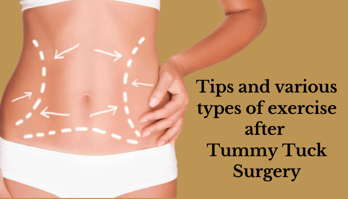 What are the different types of tummy tucks?