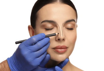 Rhinoplasty