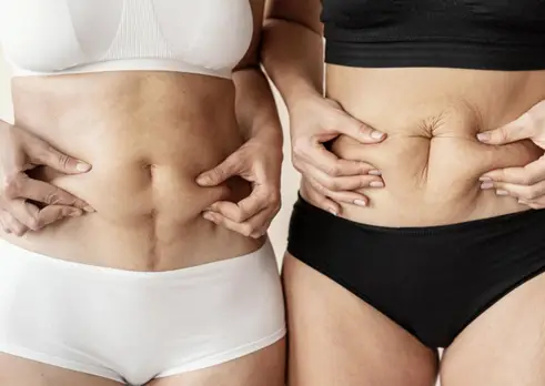 Tummy Tuck and Liposuction