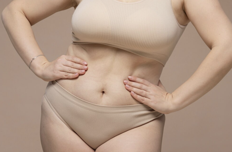 Tummy Tuck Journey