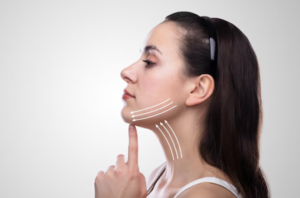 Chin Augmentation