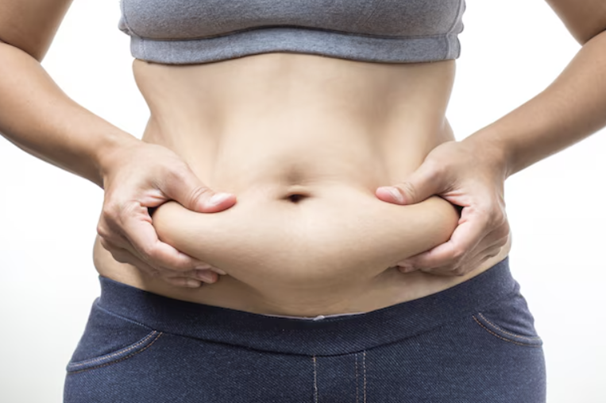 Tummy Tuck