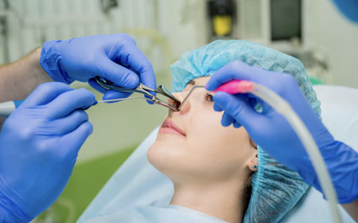 Rhinoplasty