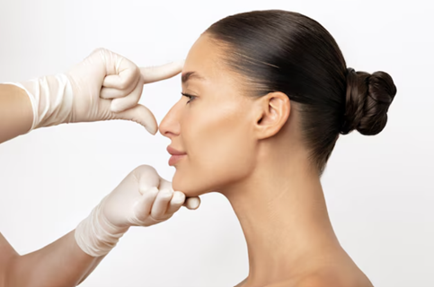 Buccal Fat Removal