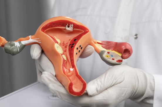 Labiaplasty