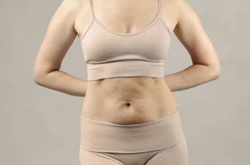 Tummy Tuck Surgery