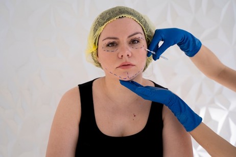 Face Lift
