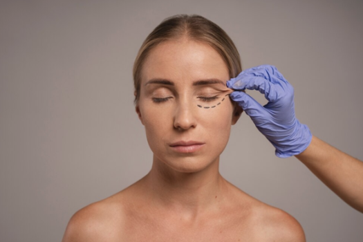 Blepharoplasty